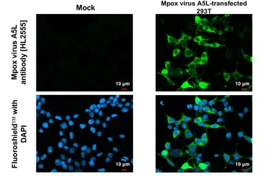 Anti-Mpox virus A5L antibody [HL2555] used in Immunocytochemistry/ Immunofluorescence (ICC/IF). GTX638927